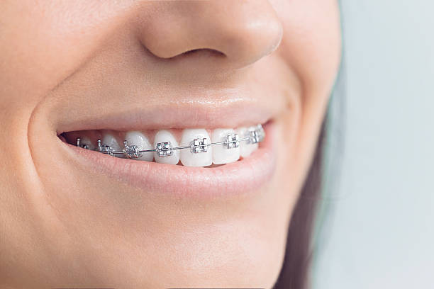 Best Dental Inlays and Onlays  in Buckeye Lake, OH